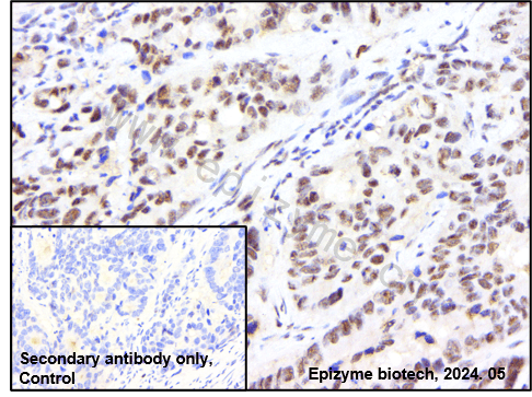 Anti-Phospho-ERK1/2 (Thr202/Thr185) Rabbit mAb [47K36K34]