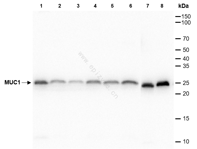 Anti-Mucin 1 Rabbit mAb [34L25M94]
