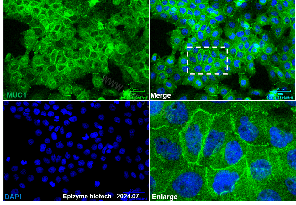 Anti-Mucin 1 Rabbit mAb [34L25M94]