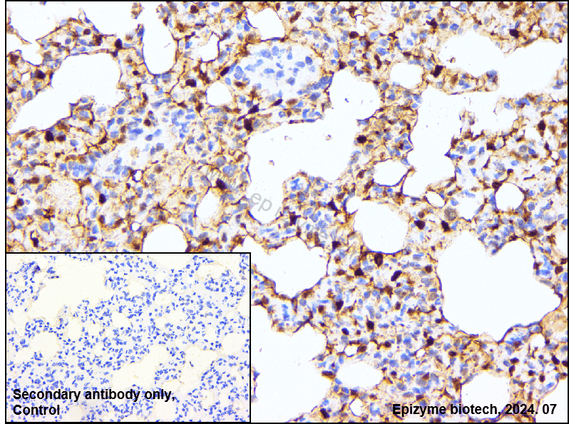 Anti-Mucin 1 Rabbit mAb [34L25M94]