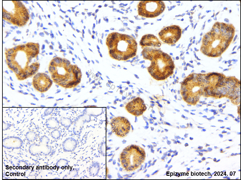 Anti-Mucin 1 Rabbit mAb [34L25M94]