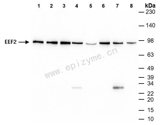 Anti-Elongation Factor 2 Rabbit mAb [14M25M86]