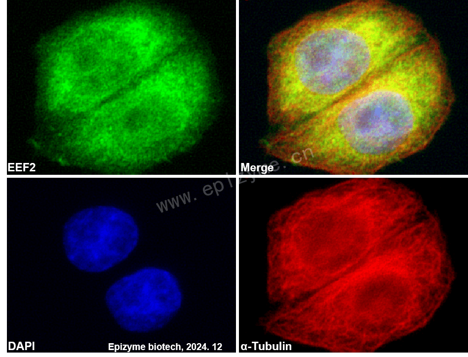 Anti-Elongation Factor 2 Rabbit mAb [14M25M86]