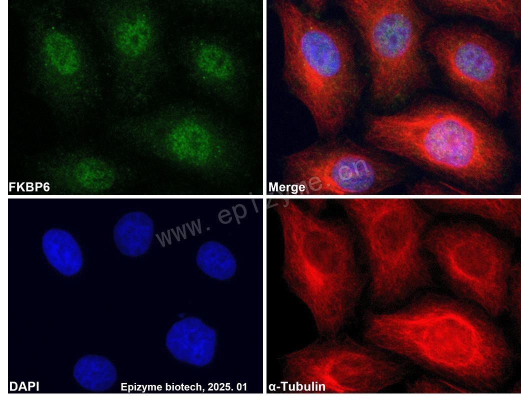 Anti-FKBP6 Rabbit mAb [21M73L93]