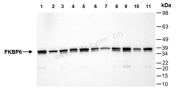 Anti-FKBP6 Rabbit mAb [21M73L93]