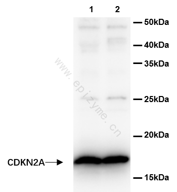 Anti-CDKN2A/p16INK4a Rabbit mAb [68K80L66]