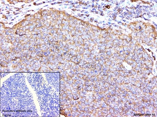 Anti-CDKN2A/p16INK4a Rabbit mAb [68K80L66]