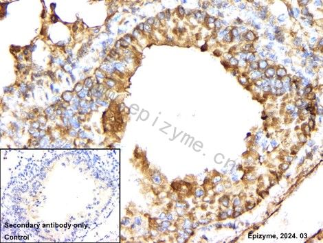 Anti-CDKN2A/p16INK4a Rabbit mAb [68K80L66]