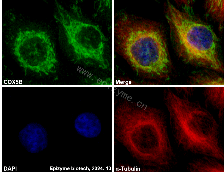 Anti-COX5B Rabbit mAb [46K74M20]
