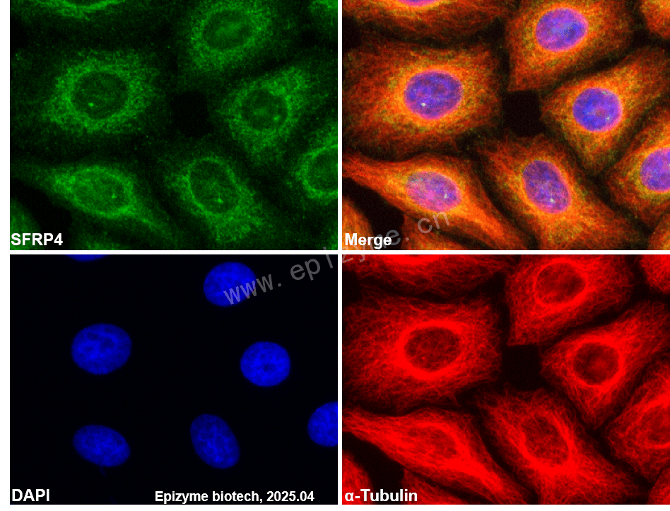 Anti-SFRP4 Rabbit mAb [66L74K02]