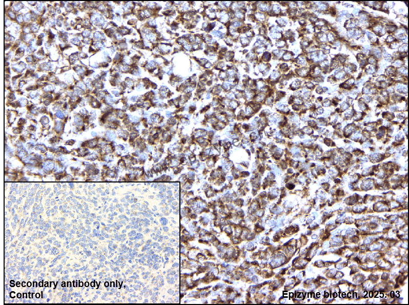 Anti-SFRP4 Rabbit mAb [66L74K02]