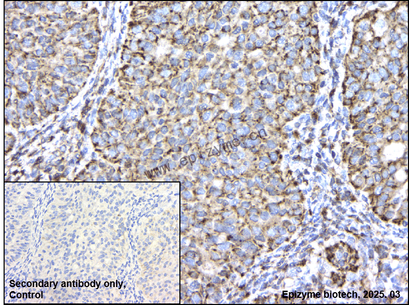 Anti-SFRP4 Rabbit mAb [66L74K02]