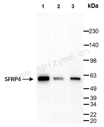 Anti-SFRP4 Rabbit mAb [66L74K02]
