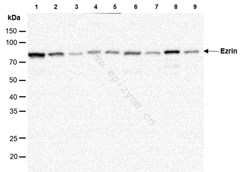 Anti-Ezrin Rabbit mAb [80K78M80]