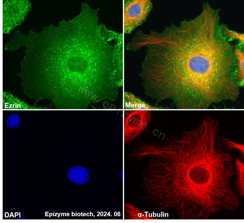 Anti-Ezrin Rabbit mAb [80K78M80]