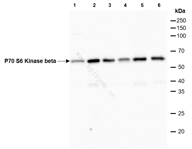 Anti-S6K2 Rabbit mAb [30K11M94]