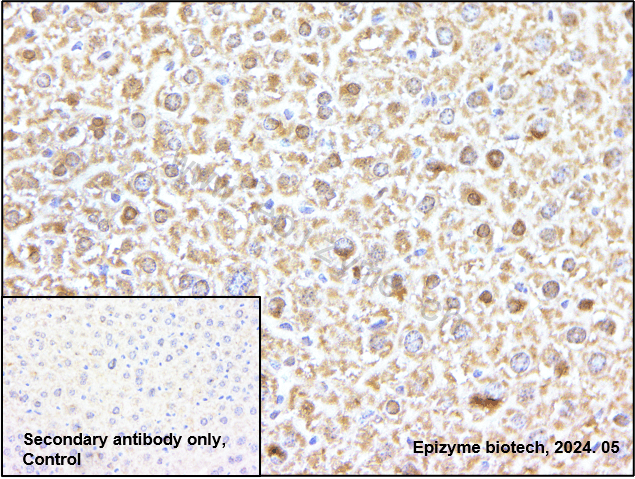 Anti-S6K2 Rabbit mAb [30K11M94]