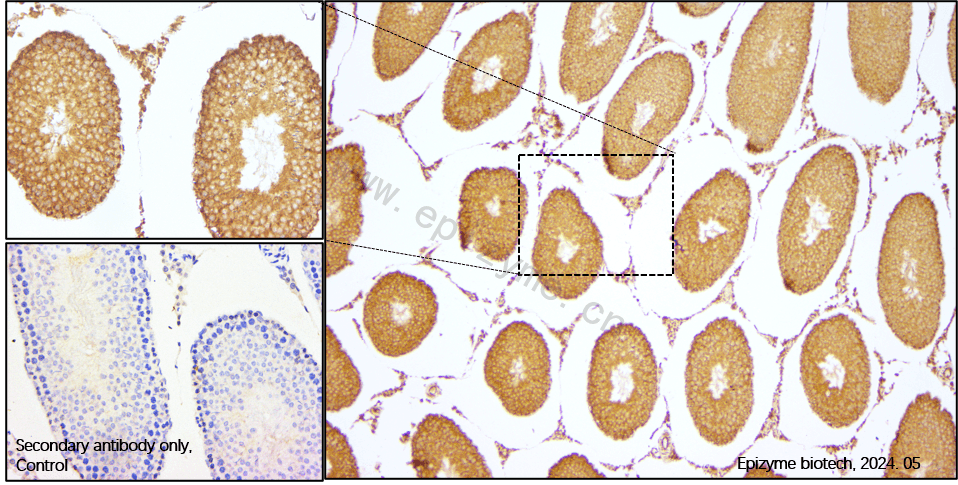Anti-S6K2 Rabbit mAb [30K11M94]