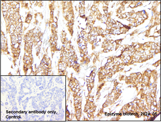 Anti-S6K2 Rabbit mAb [30K11M94]