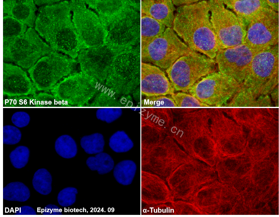 Anti-S6K2 Rabbit mAb [30K11M94]