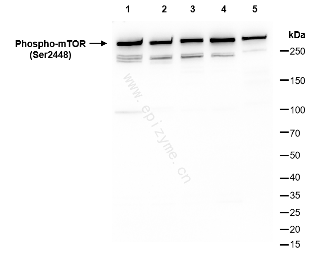 Anti-Phospho-mTOR (Ser2448) Rabbit mAb [81K48K13]