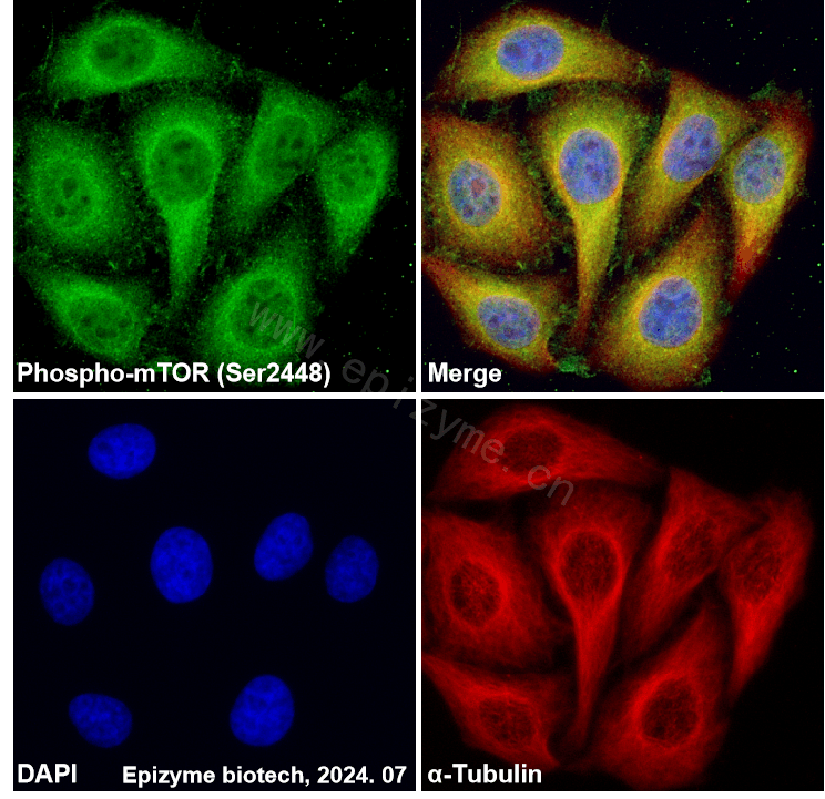 Anti-Phospho-mTOR (Ser2448) Rabbit mAb [81K48K13]