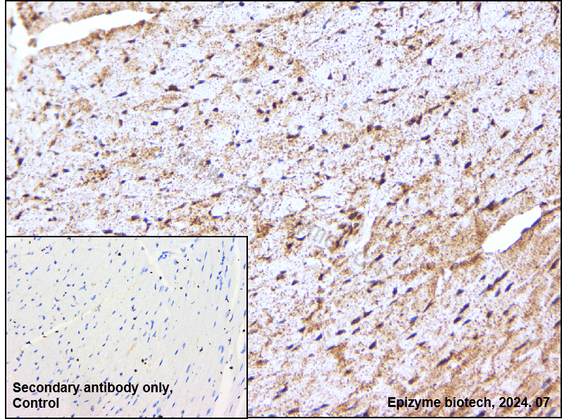 Anti-Phospho-mTOR (Ser2448) Rabbit mAb [81K48K13]
