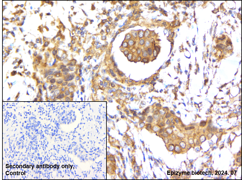 Anti-Phospho-mTOR (Ser2448) Rabbit mAb [81K48K13]