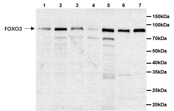 Anti-FOXO3 Rabbit mAb [77L47L17]