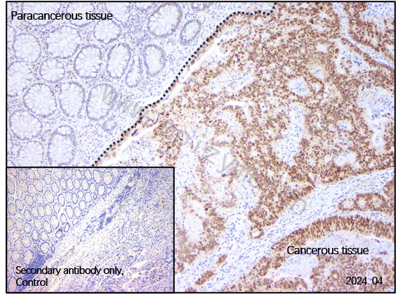 Anti-FOXO3 Rabbit mAb [77L47L17]