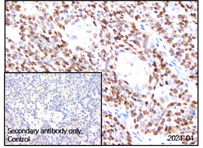Anti-FOXO3 Rabbit mAb [77L47L17]