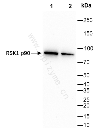 Anti-RSK1 p90 Rabbit mAb [86K72K61]