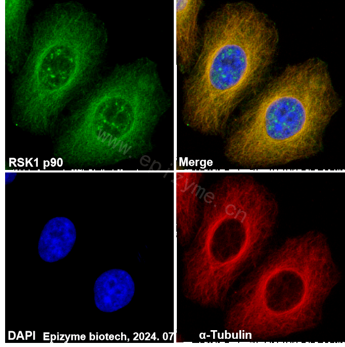 Anti-RSK1 p90 Rabbit mAb [86K72K61]