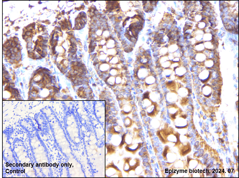 Anti-RSK1 p90 Rabbit mAb [86K72K61]