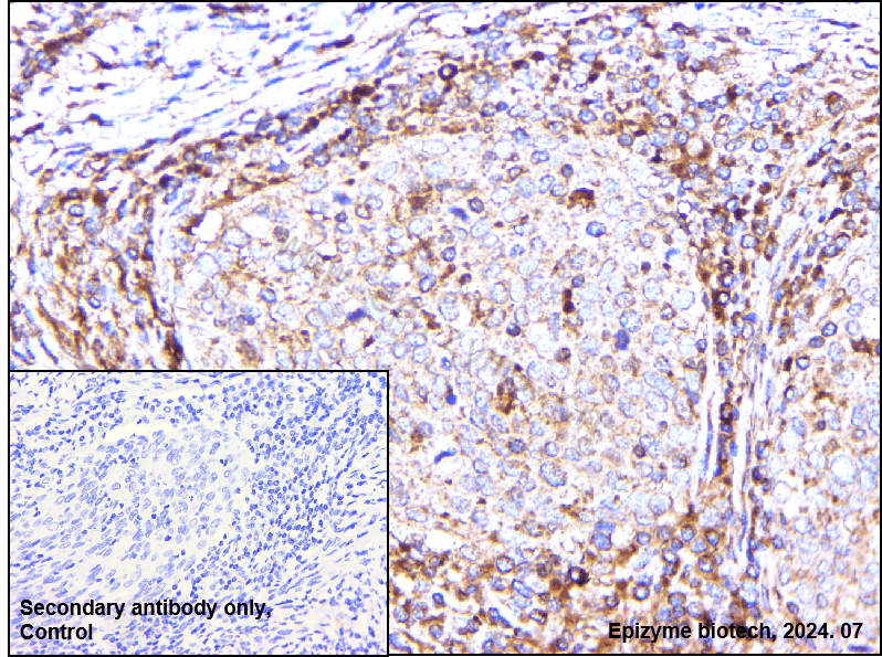 Anti-RSK1 p90 Rabbit mAb [86K72K61]