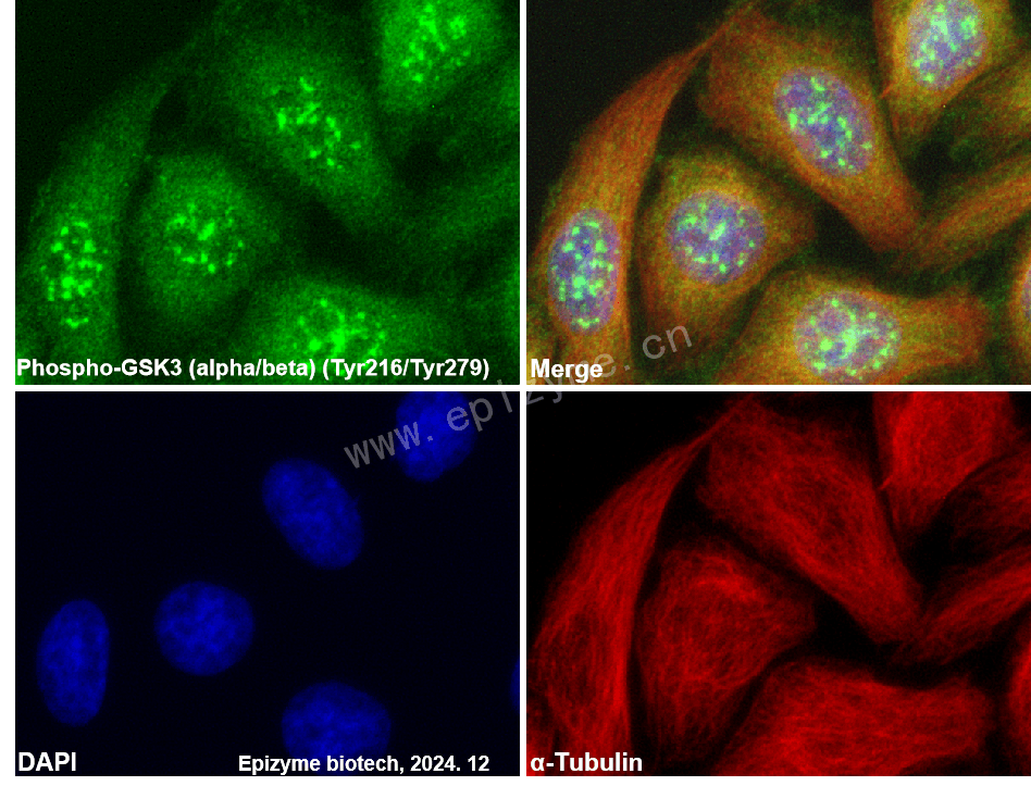 Anti-Phospho-GSK3 (Tyr216/Tyr279) Rabbit mAb [11K84M20]