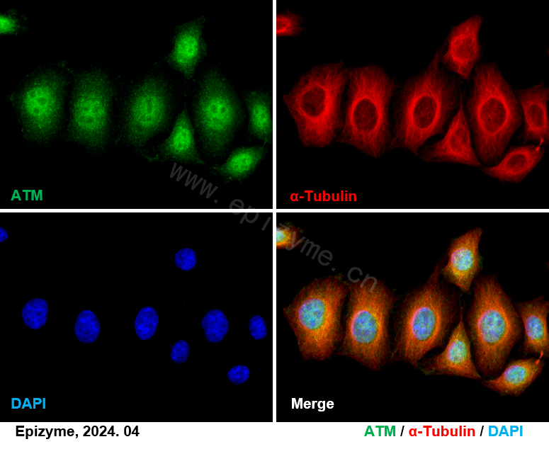 Anti-ATM Rabbit mAb [75K29L94]