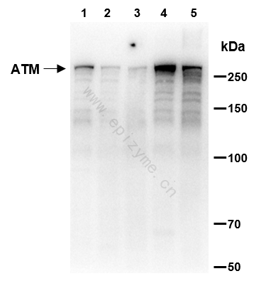 Anti-ATM Rabbit mAb [75K29L94]