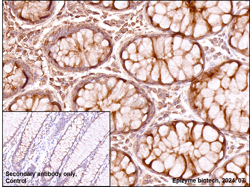 Anti-ATM Rabbit mAb [75K29L94]