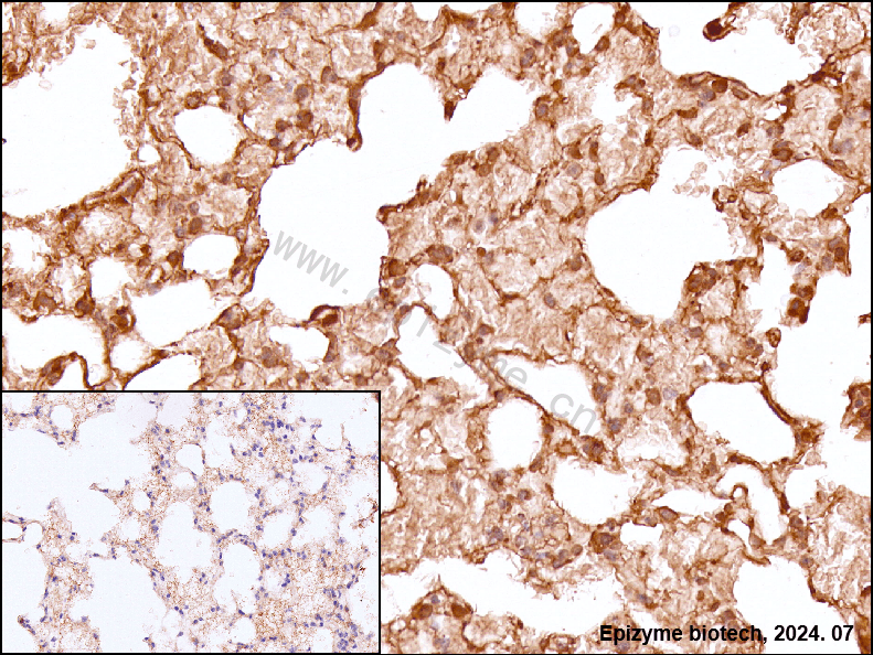 Anti-ATM Rabbit mAb [75K29L94]