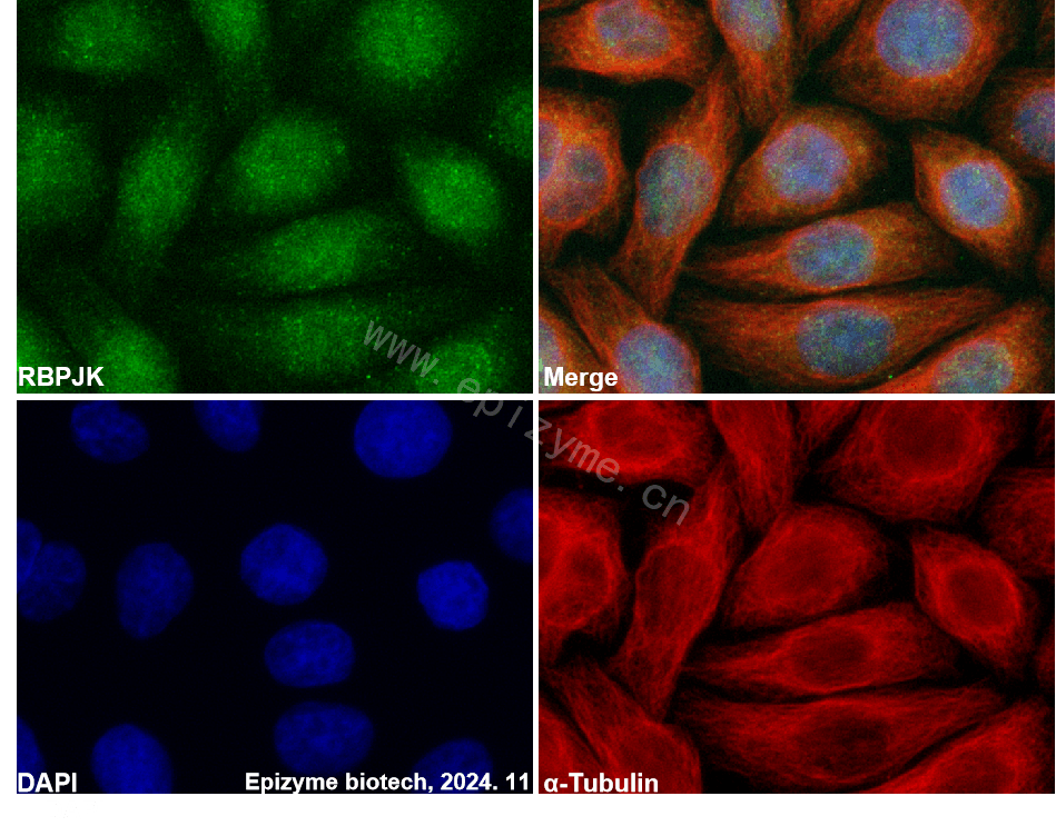 Anti-RBPJK Rabbit mAb [75L81M06]