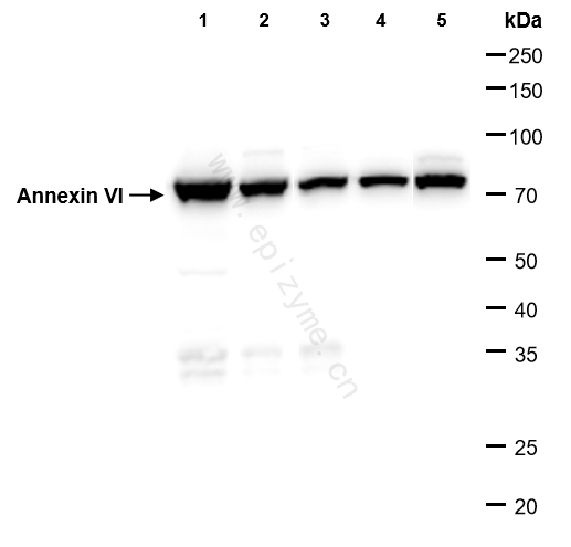 Anti-Annexin VI Rabbit mAb [47L41L64]