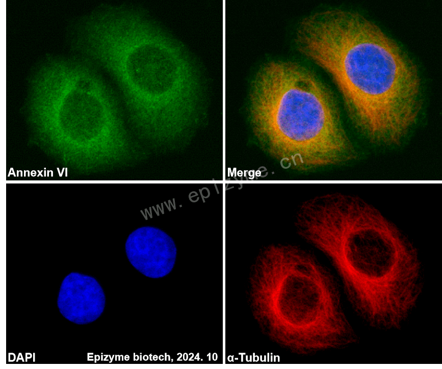 Anti-Annexin VI Rabbit mAb [47L41L64]