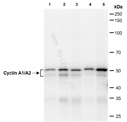 Anti-Cyclin A1/A2 Rabbit mAb [23M93K84]
