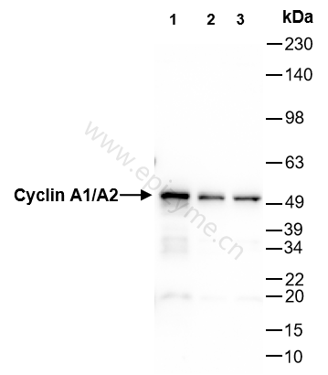Anti-Cyclin A1/A2 Rabbit mAb [23M93K84]
