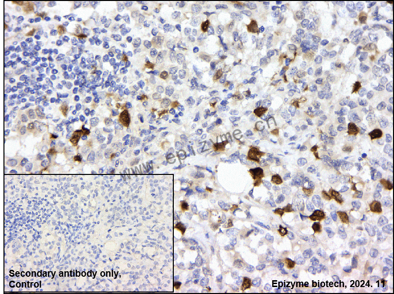 Anti-Phospho-CDK2 (Thr14) Rabbit mAb [18M37L04]