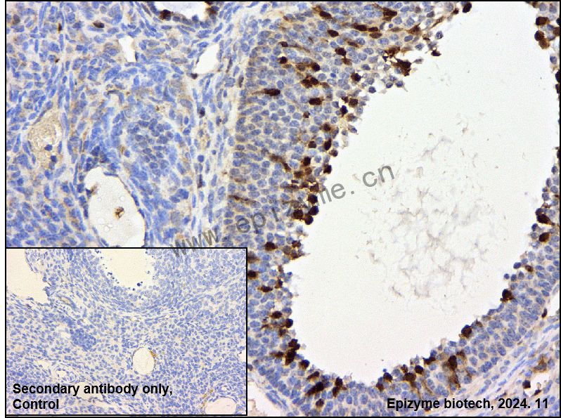 Anti-Phospho-CDK2 (Thr14) Rabbit mAb [18M37L04]