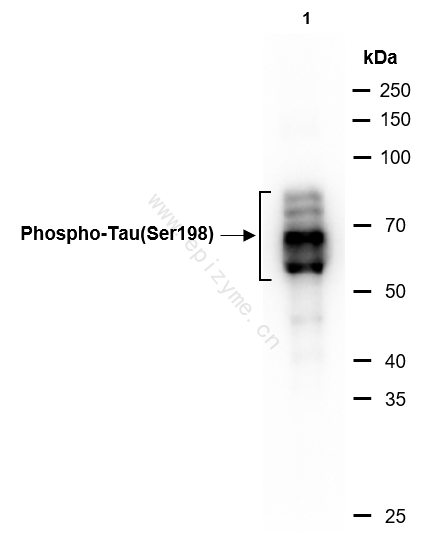 Anti-Phospho-Tau (Ser198) Rabbit mAb [77K15L67]