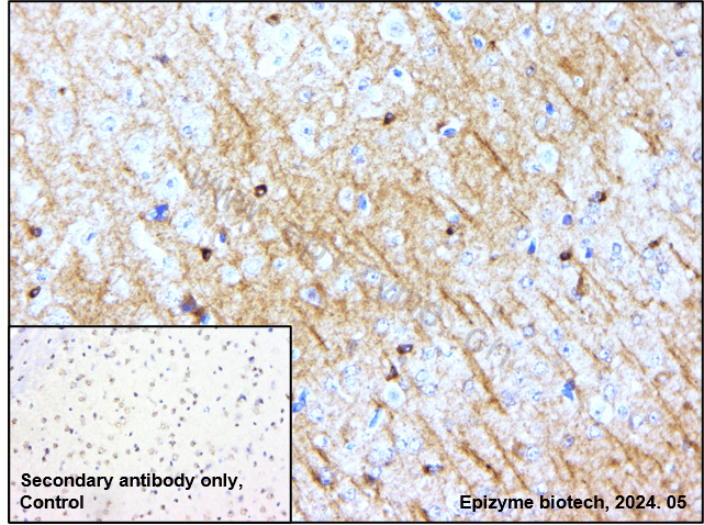 Anti-Phospho-Tau (Ser198) Rabbit mAb [77K15L67]