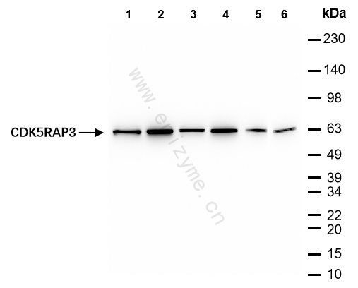 Anti-CDK5RAP3 Rabbit mAb [69M02M13]